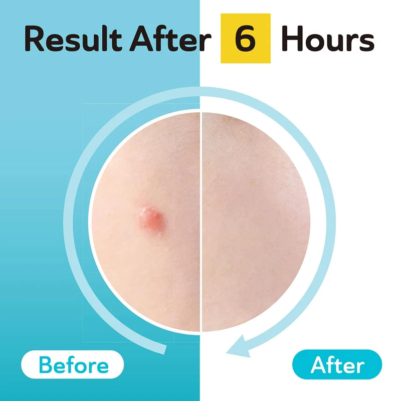 DermaAngel Clear Patch Original Invisible+