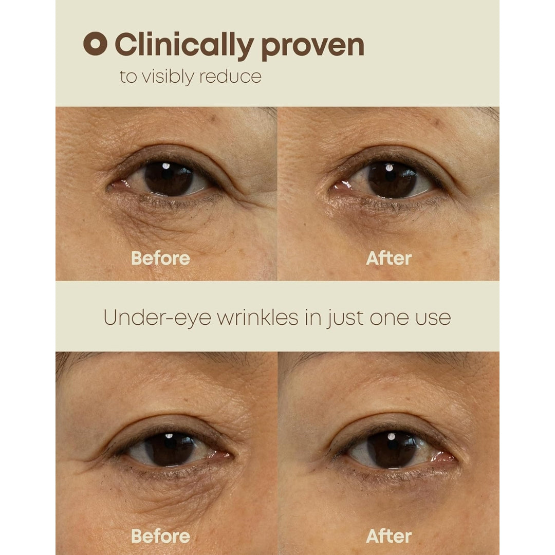 NINELESS Ever-Youth Dual Effect Eye Cream