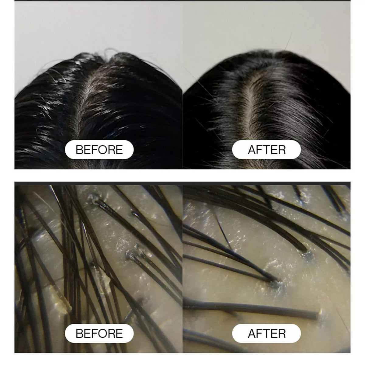 GROWUS Sea Salt Therapy Scalp Scaler