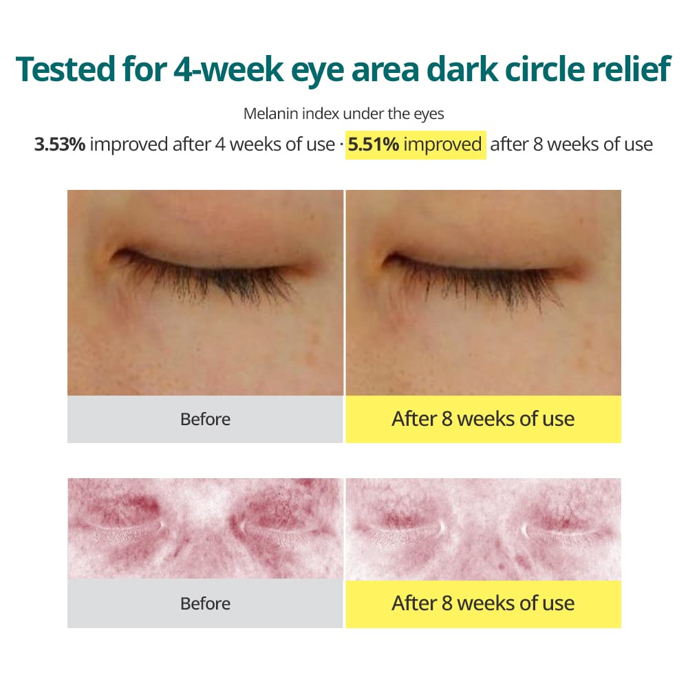 Goodal Green Tangerine Vitamin C Dark Circle Eye Cream Beauty Goodal