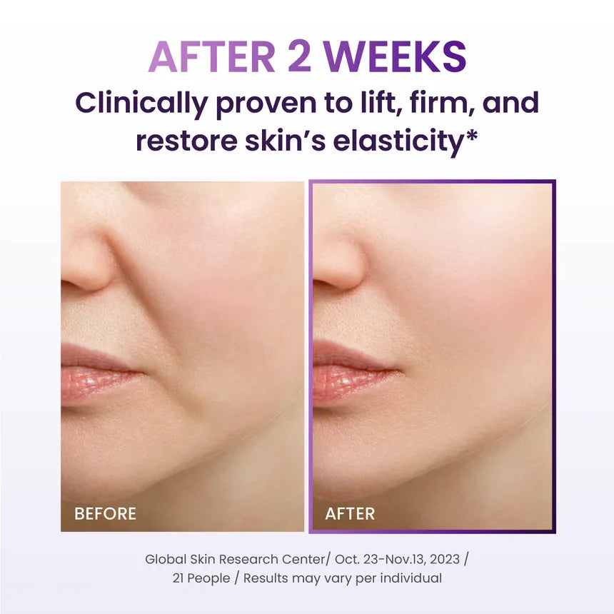 BIOHEAL BOH Probioderm 3D Lifting Travel Kit