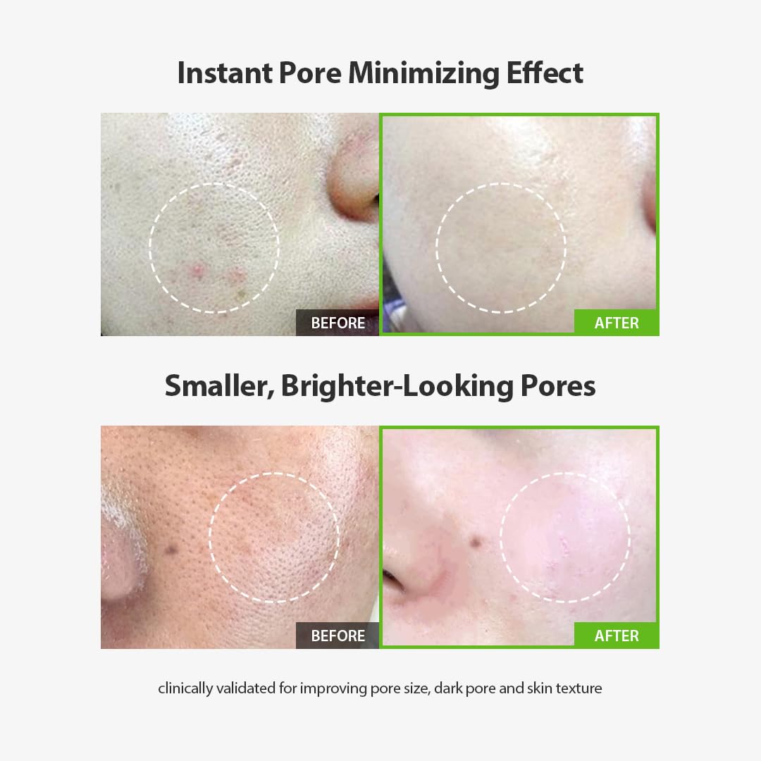 Sungboon Editor Green Tomato Pore Lifting Ampoule