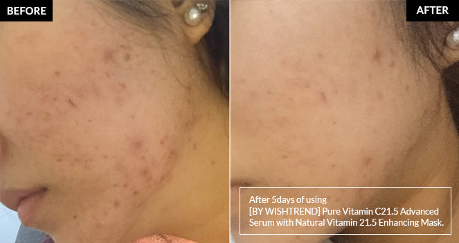 By Wishtrend Natural Vitamin 21.5 Enhancing Sheet Mask Beauty By Wishtrend   